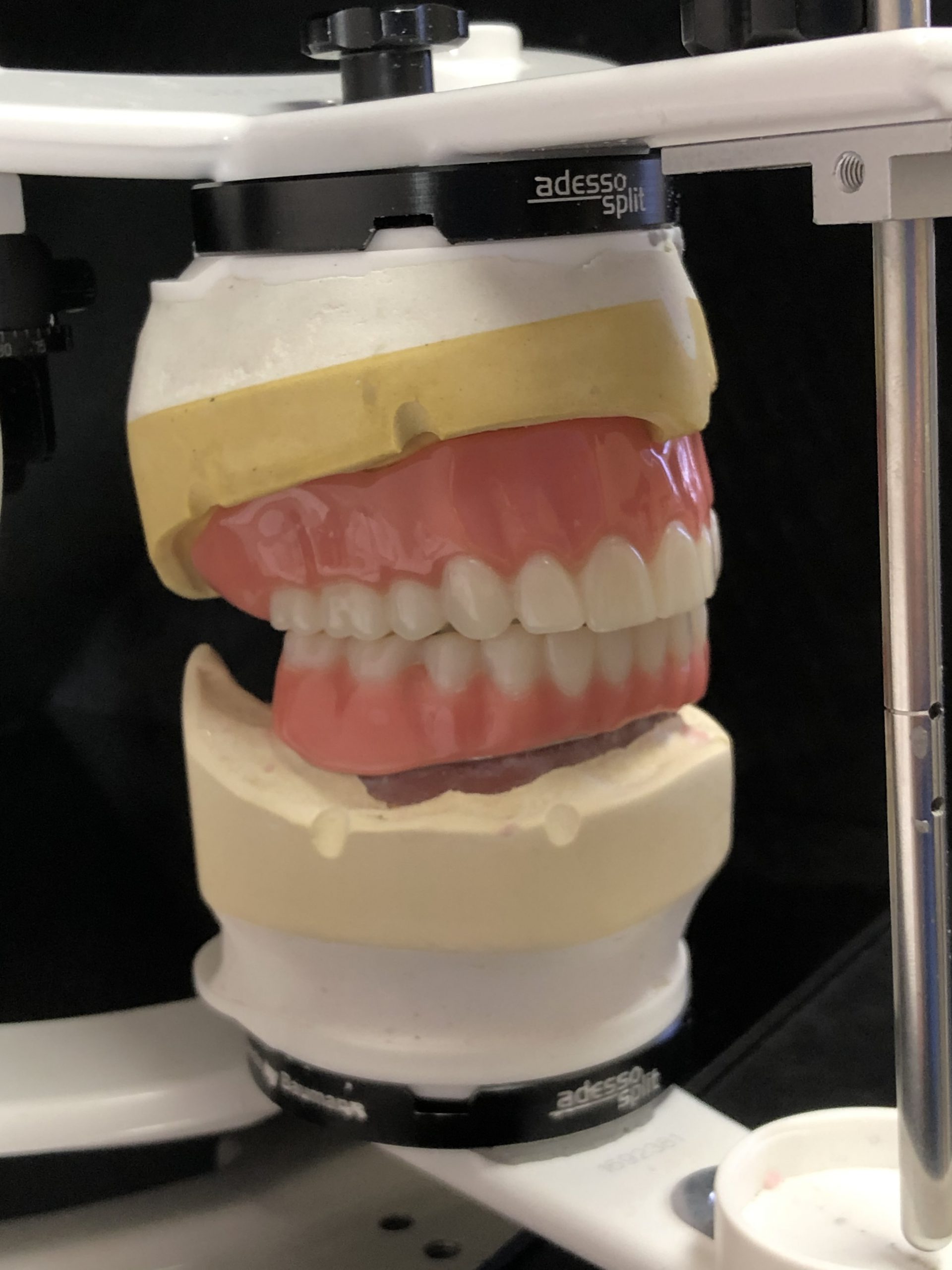 milled-denture-scaled.jpg